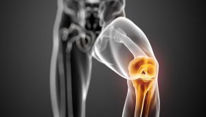 النسيج الأنفي لإصلاح تلف مفصل الركبة
