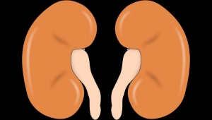 لحماية الكلى.. 10 أسئلة يجب أن تطرحها على طبيبك قبل استعمال مسكنات الألم