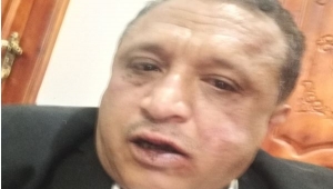 منظمة حقوقية تدين اعتداء الحوثيين على الصحفي "الصمدي" في صنعاء