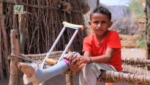 أونمها: مقتل وإصابة 4 أشخاص بإنفجار ألغام الحوثيين في الحديدة خلال مايو الماضي