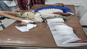 للمرة الثالثة.. إصابة مواطن برصاص قناص حوثي في تعز