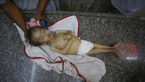 غزة.. ارتفاع وفيات التجويع الإسرائيلي إلى 154 فلسطينيا بينهم 89 طفلا