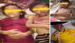 وفاة ثلاثة أطفال نتيجة إنهيار منزل جراء الأمطار في حجة