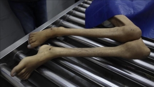 ارتفاع عدد وفيات التجويع الإسرائيلي بغزة إلى 303 فلسطينيين