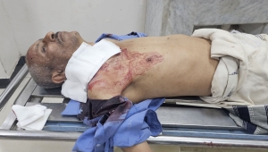 مقتل مواطن برصاص قناص حوثي غرب تعز