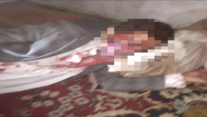 صنعاء.. مقتل وإصابة أربعة أشخاص بطريقة مروعة