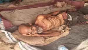 وفاة أحد النازحين جوعا في إحدى مخيمات حجة