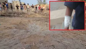 حجة.. إصابة طفل بقصف حوثي في عبس
