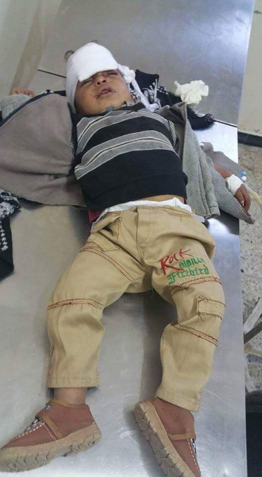 مجزرة جديدة لمليشيا الحوثي والمخلوع راح ضحيتها 15 مدني بينهم أطفال في تعز (صور)