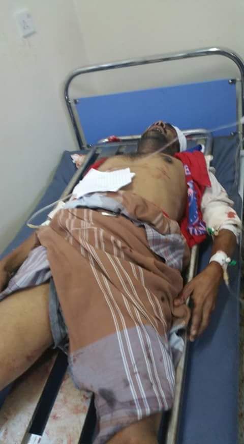 مجزرة جديدة لمليشيا الحوثي والمخلوع راح ضحيتها 15 مدني بينهم أطفال في تعز (صور)