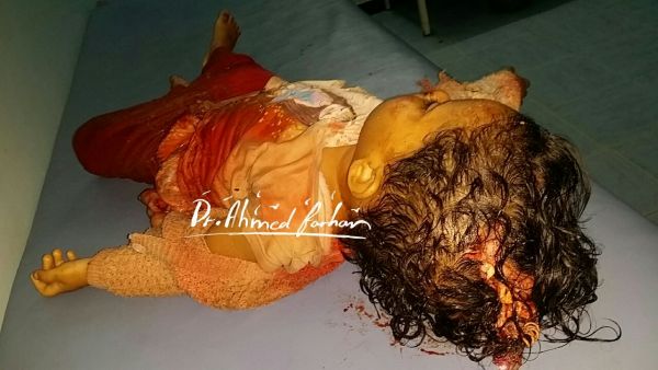 مليشيا الحوثي ترتكب مجزرة جديدة بتعز راح ضحيتها 3 قتلى و7 جرحى معظمهم من الأطفال (صور)