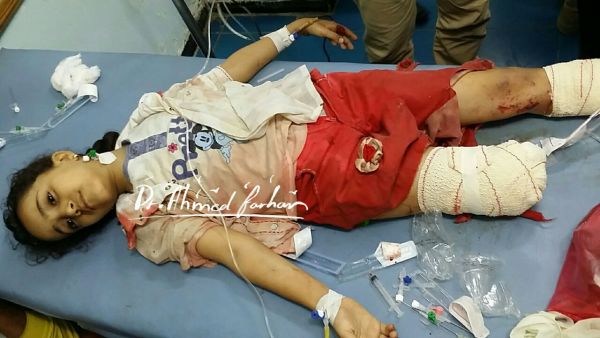مليشيا الحوثي ترتكب مجزرة جديدة بتعز راح ضحيتها 3 قتلى و7 جرحى معظمهم من الأطفال (صور)