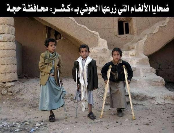 إحصائية : 2558 طفل ضحايا مليشيات الحوثي في حجة منذ 2011م وحتى 2016م