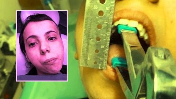 المرض الذي منع فاطمة اليمنية من فتح فمها طوال 30 سنة