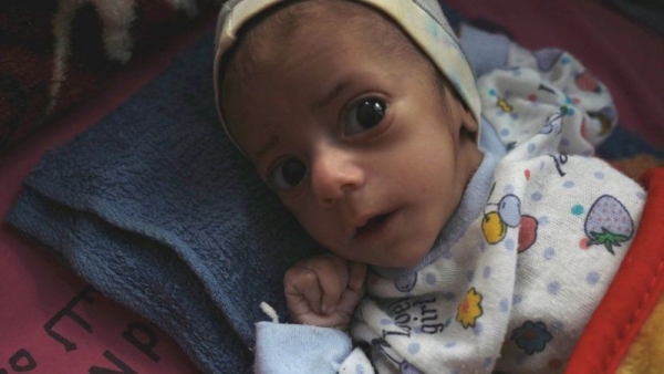 الحرب في اليمن: مدينة مأرب تعيش مأساة إنسانية في ظل 