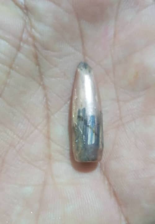 حضرموت.. إصابة طفلة برصاص راجع