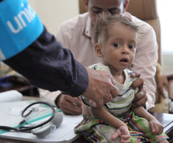 الأمم المتحدة: المناطق التي تقع تحت سيطرة الحكومة اليمنية تواجه إنعدام للأمن الغذائي