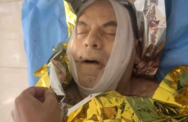 الغذاء العالمي يؤكد مقتل مدير مكتبه في تعز ويعتبر الحادثة 