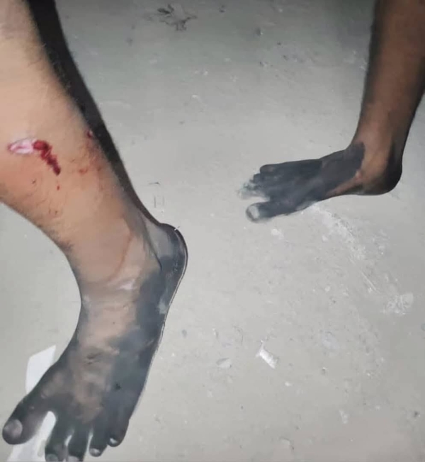 وسط احتجاجات غاضبة.. سقوط جريحين بصفوف المتظاهرين في حضرموت