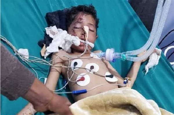 إصابة امرأة وطفلين في حادث سير بالضالع