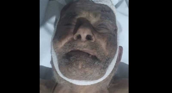 وفاة شخص مجهول الهوية في حادث سير بإب