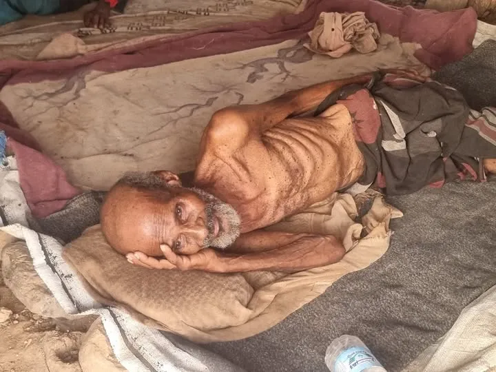 وفاة أحد النازحين جوعا في إحدى مخيمات حجة