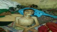 نجلاء العمري تكتب عن قصة طفل يمني مات من الجوع