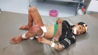 الجوف.. إصابة أربعة أطفال بقصف للحوثيين استهدف نازحين (صور)