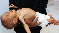 الغارديان: معاناة المدنيين في اليمن ليست أسوأ أزمة إنسانية بل جريمة