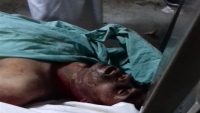 جماعة الحوثي بعمران تعذب مواطنا حتى الموت ومصير سبعة من أسرته مجهول
