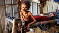 اليمن.. طفل يموت كل 70 ثانية في "أعظم مجاعة بالتاريخ الحديث"