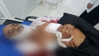 في ثالث أيام الهدنة..  إصابة مدنيين إثنين برصاص قناص حوثي في تعز