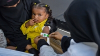 الحوثيون: سوء التغذية يهدد أكثر من أربعة ملايين طفل في اليمن