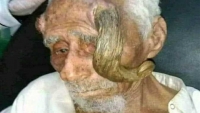 "ذو القرنين".. قصة المُعمّر اليمني الذي عاش 140 عامًا ومات بخطأ طبي
