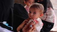 الأمم المتحدة: منع الحوثيين حملات التطعيم تسبب بعودة تفشي مرض شلل الأطفال بمناطق سيطرتهم